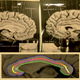 Illustration for article titled This Is Why Einsteins Brain Was Better Than Yours
